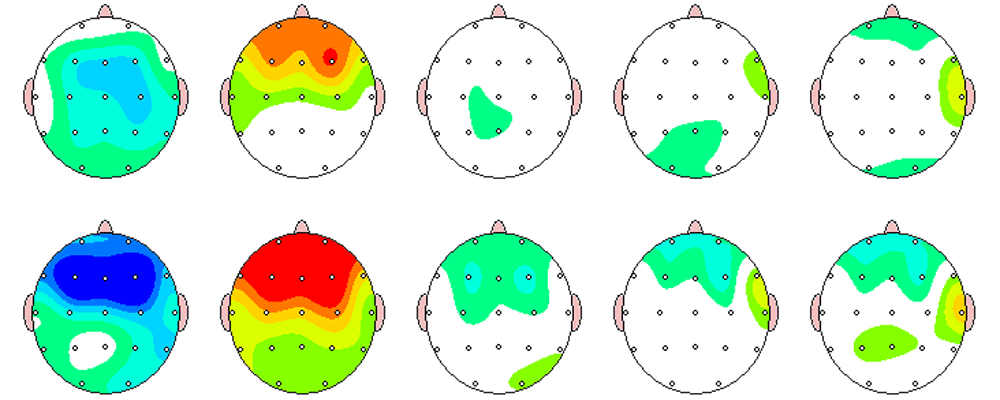 brainmap-nar-c