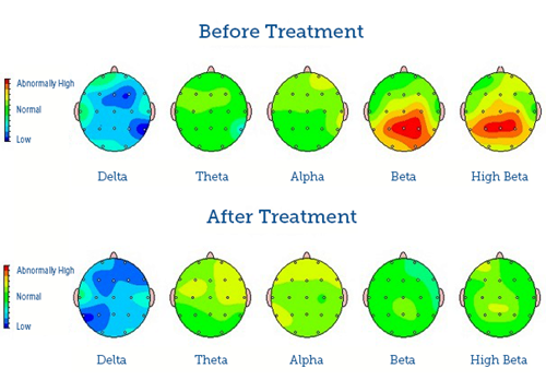 brainmapping2